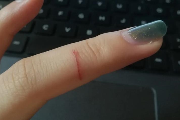 诺阿朗手指严重割伤！ESPN晒照，工作人员对其受伤的地点检查